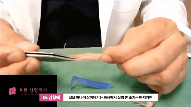 하이코 실리프팅 실제거, 실을 한꺼번에 제거하는 것이 좋은 세 가지 이유 관련 이미지 3/17