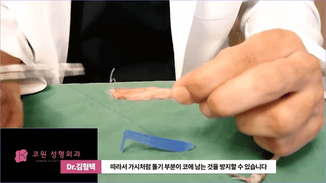 하이코 실리프팅 실제거, 실을 한꺼번에 제거하는 것이 좋은 세 가지 이유 관련 이미지 5/17