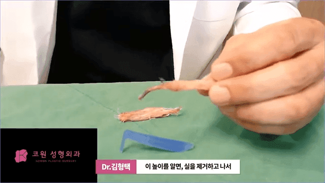 하이코 실리프팅 실제거, 실을 한꺼번에 제거하는 것이 좋은 세 가지 이유 관련 이미지 7/17