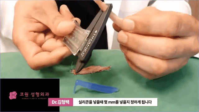 하이코 실리프팅 실제거, 실을 한꺼번에 제거하는 것이 좋은 세 가지 이유 관련 이미지 8/17