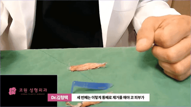 하이코 실리프팅 실제거, 실을 한꺼번에 제거하는 것이 좋은 세 가지 이유 관련 이미지 10/17