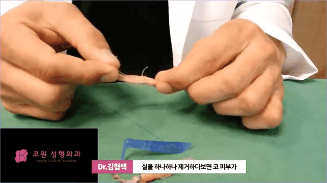 하이코 실리프팅 실제거, 실을 한꺼번에 제거하는 것이 좋은 세 가지 이유 관련 이미지 12/17