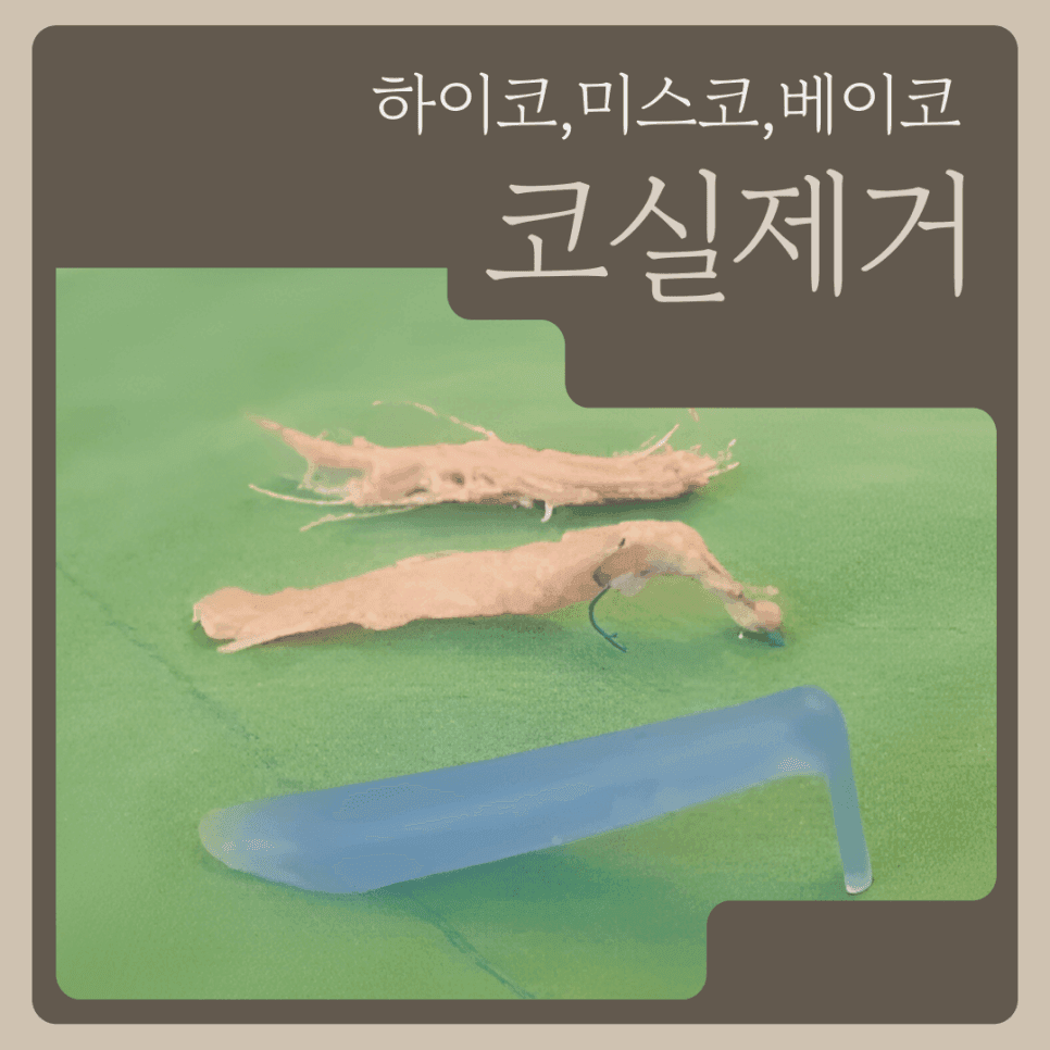 코실 제거, 왜 그냥 뽑으면 안 될까 — 남는 흉살과 제거 후 재건까지 보는 이유 관련 이미지 1/5
