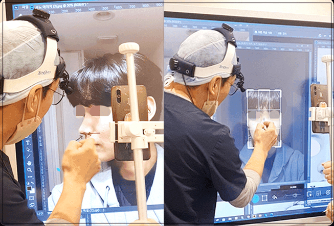 비공내리기, 코끝만 내리면 안 되는 이유 — 구조 분석과 재료 선택 관련 이미지 7/7
