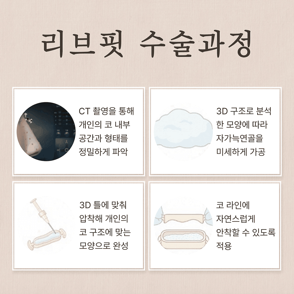 찝힌코, 코재수술이 필요한 상태일까 — 구조 점검이 필요한 다섯 가지 신호 관련 이미지 6/6