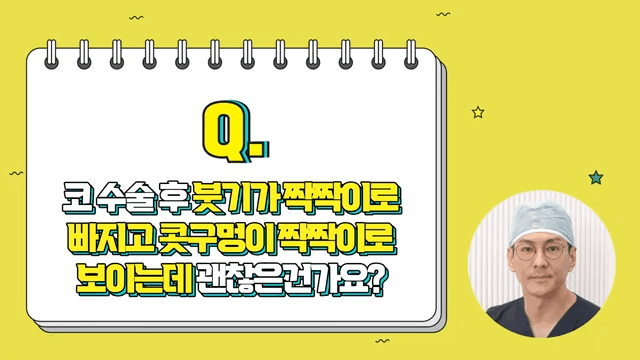 코성형 후 콧구멍이 짝짝이로 보여요 — 붓기·소독·미간 부음 질문 정리 관련 이미지 2/5