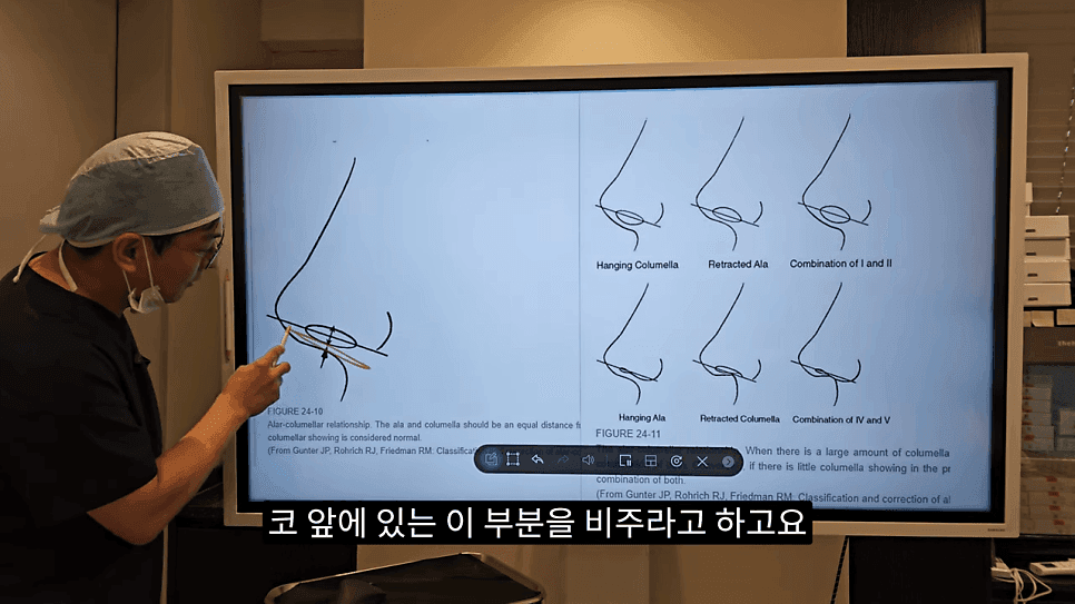 돌출입코성형과 ACR — 비주와 콧날개의 관계가 비순각·비주내리기를 결정하는 이유 관련 이미지 3/31