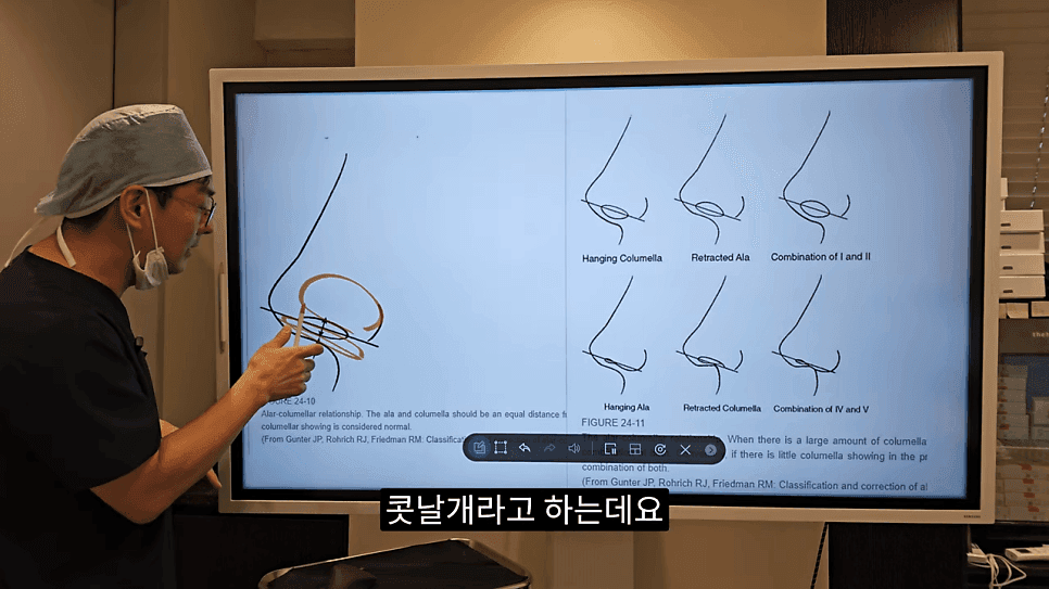 돌출입코성형과 ACR — 비주와 콧날개의 관계가 비순각·비주내리기를 결정하는 이유 관련 이미지 4/31