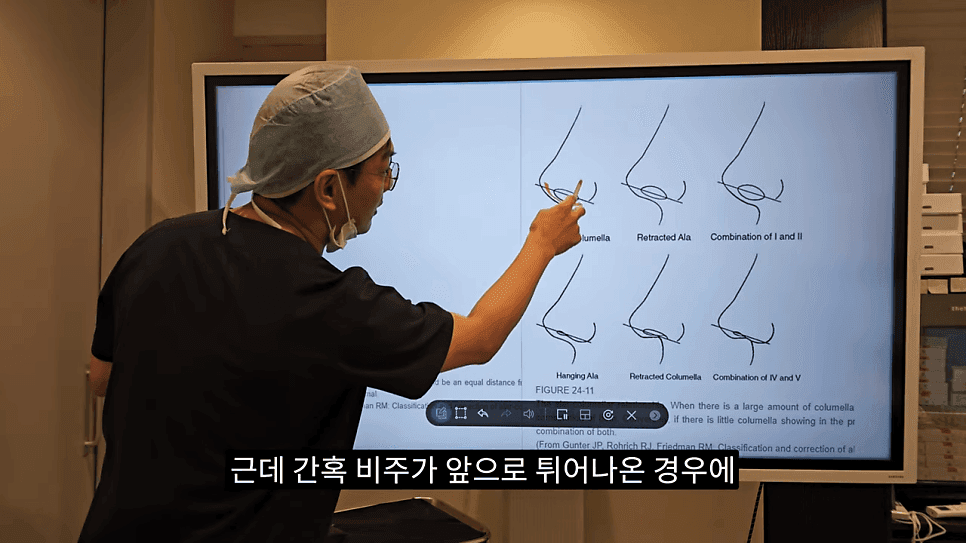 돌출입코성형과 ACR — 비주와 콧날개의 관계가 비순각·비주내리기를 결정하는 이유 관련 이미지 7/31