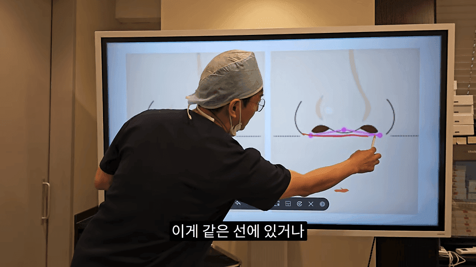 돌출입코성형과 ACR — 비주와 콧날개의 관계가 비순각·비주내리기를 결정하는 이유 관련 이미지 13/31