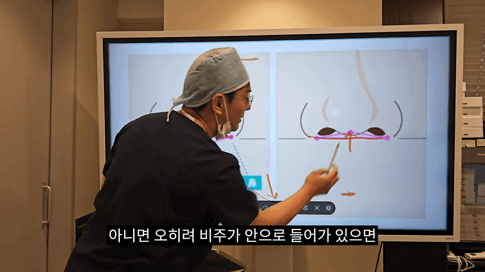 돌출입코성형과 ACR — 비주와 콧날개의 관계가 비순각·비주내리기를 결정하는 이유 관련 이미지 14/31