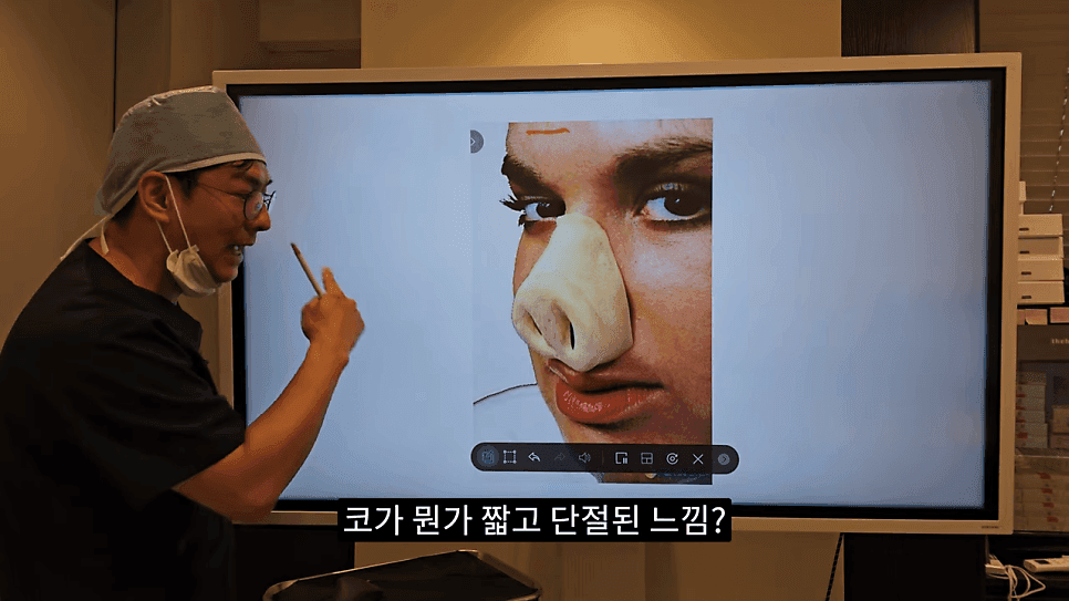 돌출입코성형과 ACR — 비주와 콧날개의 관계가 비순각·비주내리기를 결정하는 이유 관련 이미지 19/31