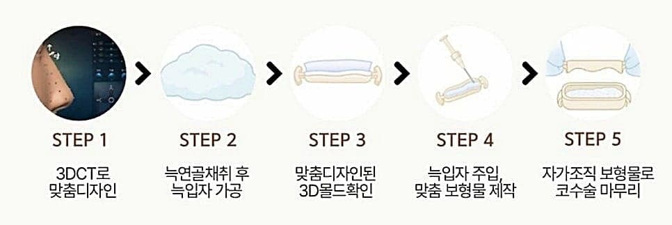 코수술 병원을 고를 때 확인하는 세 가지 — 염증 대비·비순각·예상 결과 관련 이미지 3/3