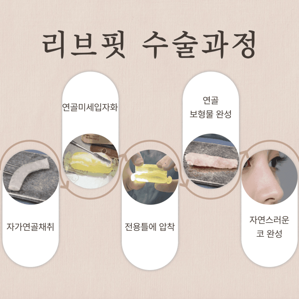 코수술 병원, 전후 사진보다 먼저 봐야 할 기준 — 재료 선택과 상담 확인 항목 관련 이미지 5/7