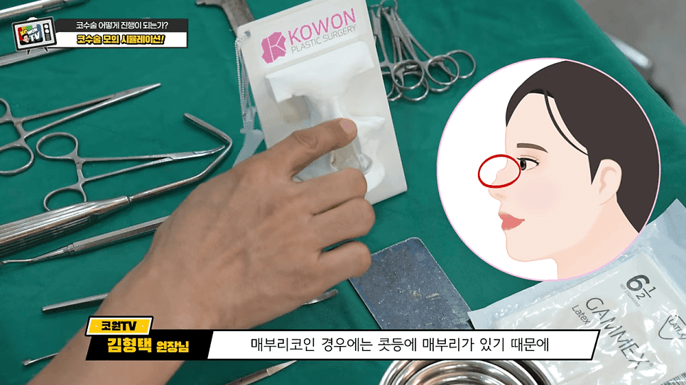 코수술 Q&A — 수술 도구 소독, 매부리코와 복코의 차이, 재수술은 무엇이 다른가 관련 이미지 8/15