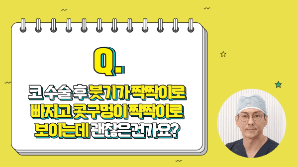 코성형 붓기, 언제까지 얼마나 붓나요? — 시기별 경과와 냉찜질·온찜질 관리 관련 이미지 2/5