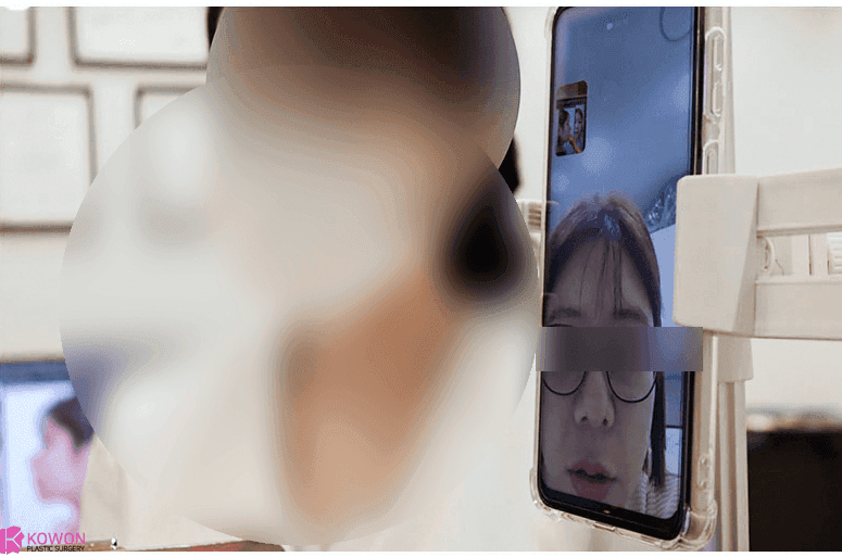 늑연골코성형을 알아볼 때 확인하는 세 가지 — 와핑, 원하는 형태, 회복 기간 관련 이미지 8/8