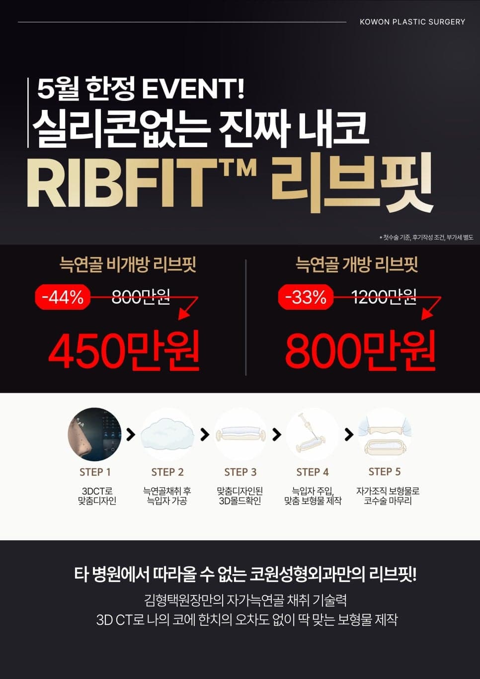 자가늑입자 보형물 RIBFIT™ 리브핏은 어떻게 만드나요 — CT 기반 맞춤 몰드와 수술 단계 관련 이미지 5/5