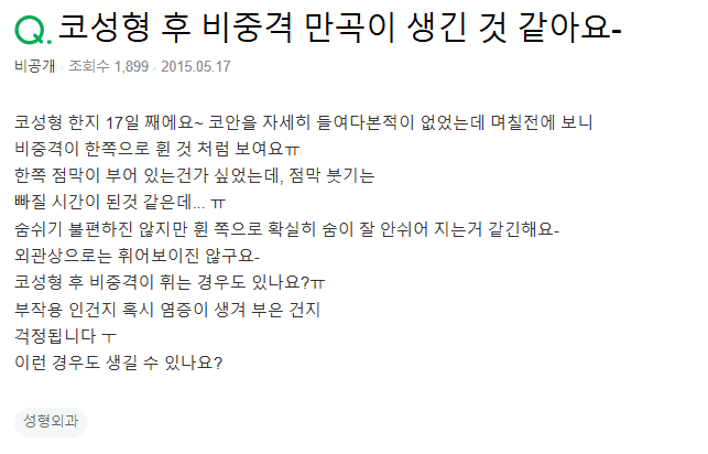 코성형 17일차, 비중격연골이 휘어 보인다면 — 점막 붓기와 구분하는 순서 관련 이미지 2/2