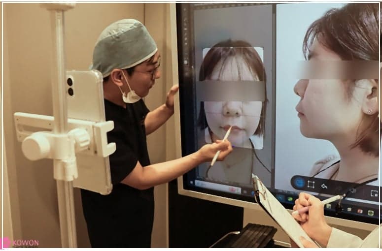 코성형 전후, 짧은 코끝을 비중격 연장술로 개선할 때 확인할 점 관련 이미지 8/9