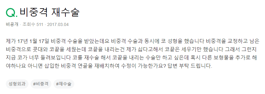 비중격수술 후 들창코처럼 보일 때 — 코끝 연골 재배치로 코재수술이 되나요? 관련 이미지 2/2
