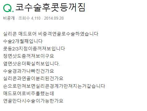 실리콘 코수술 2개월, 콧등이 함몰된 것 같다면 — 재수술을 결정하기 전에 확인할 것 관련 이미지 2/4