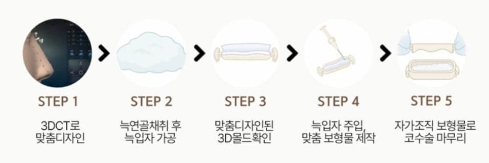 สามารถสร้างรูปทรงจมูกได้โดยไม่ต้องใช้ซิลิโคนหรือไม่? —ศัลยกรรมจมูก ไม่ใช้อิมแพลนต์ลิโคนและ RIBFIT™ ภาพประกอบที่เกี่ยวข้องกับหลักการของ RIBFIT™ 2/4