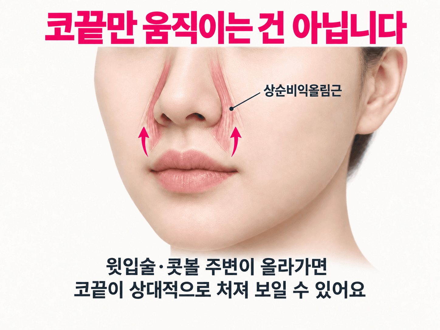 상순비익올림근의 대략적인 위치와 윗입술·콧볼 주변의 위 방향 움직임을 표시한 설명 그림