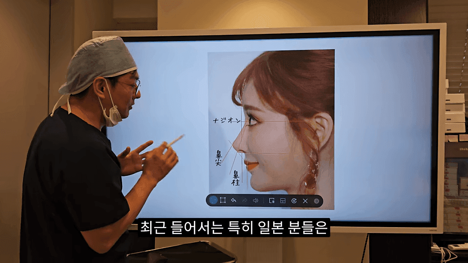 사각코성형이란 — 비주가 살짝 꺾이는 디자인이 자연스러워 보이는 이유 관련 이미지 1/25