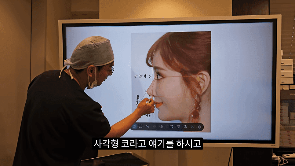 사각코성형이란 — 비주가 살짝 꺾이는 디자인이 자연스러워 보이는 이유 관련 이미지 2/25