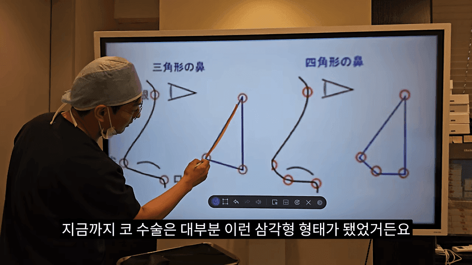 사각코성형이란 — 비주가 살짝 꺾이는 디자인이 자연스러워 보이는 이유 관련 이미지 3/25