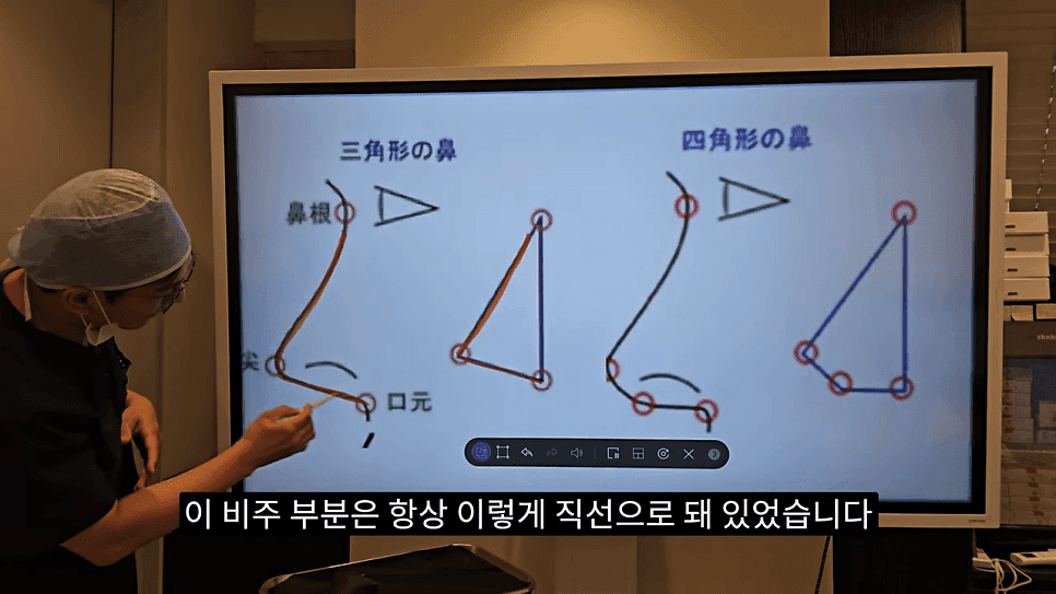 사각코성형이란 — 비주가 살짝 꺾이는 디자인이 자연스러워 보이는 이유 관련 이미지 4/25