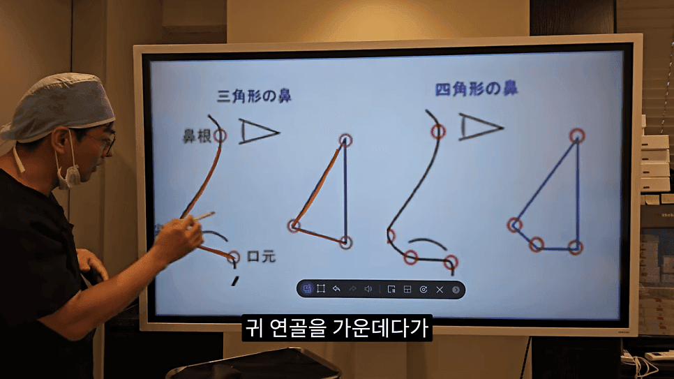 사각코성형이란 — 비주가 살짝 꺾이는 디자인이 자연스러워 보이는 이유 관련 이미지 5/25