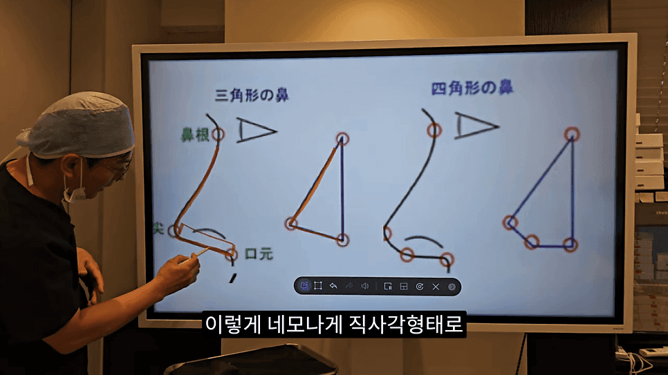 사각코성형이란 — 비주가 살짝 꺾이는 디자인이 자연스러워 보이는 이유 관련 이미지 6/25