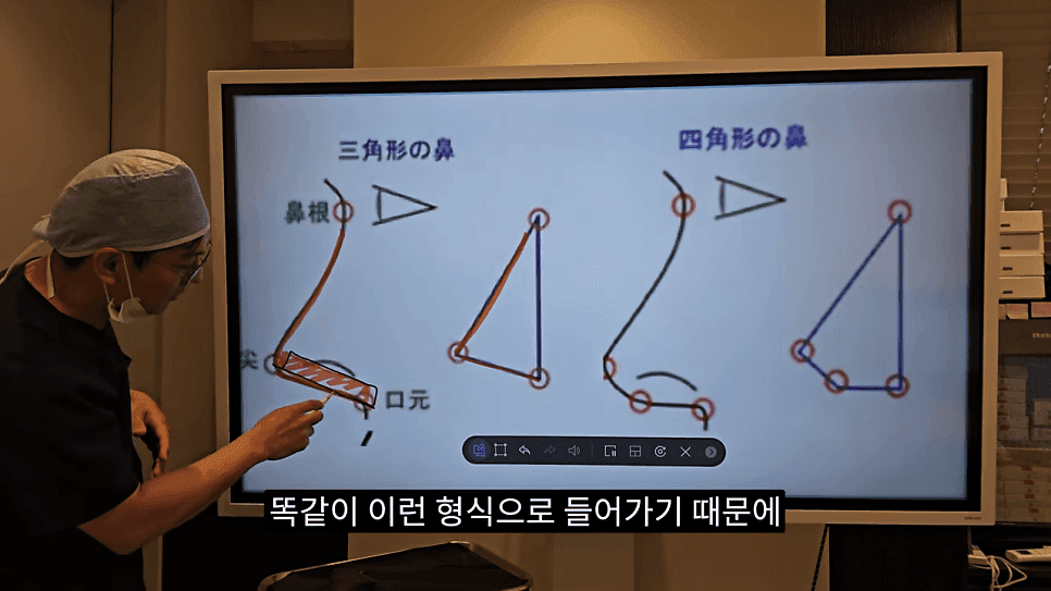 사각코성형이란 — 비주가 살짝 꺾이는 디자인이 자연스러워 보이는 이유 관련 이미지 8/25