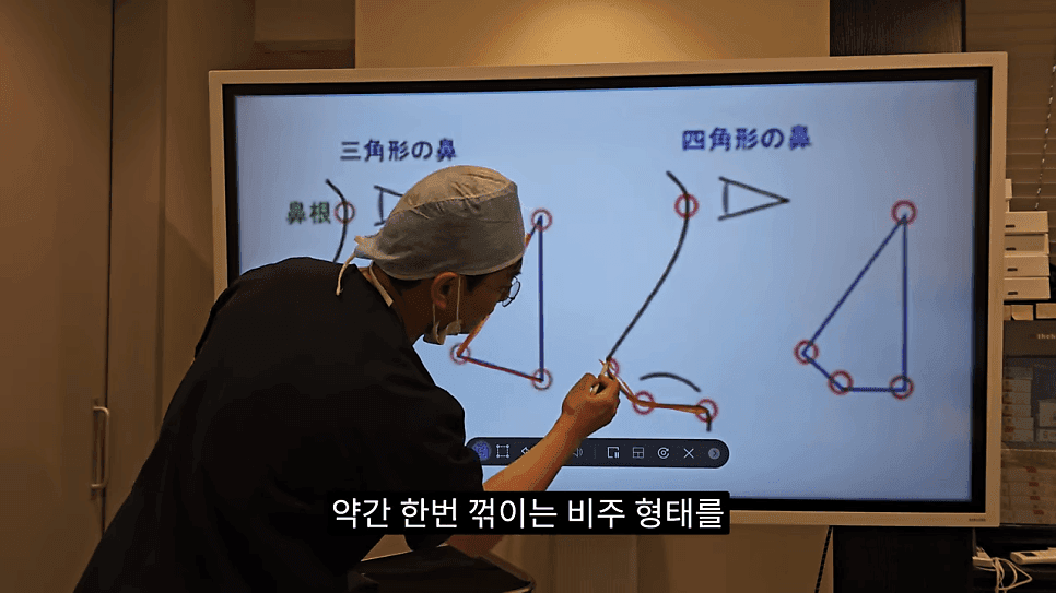 사각코성형이란 — 비주가 살짝 꺾이는 디자인이 자연스러워 보이는 이유 관련 이미지 9/25