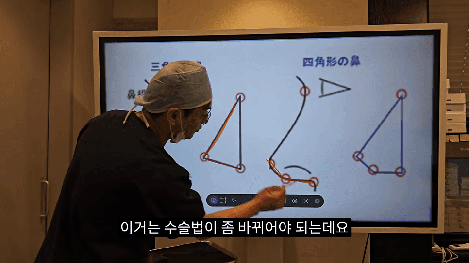 사각코성형이란 — 비주가 살짝 꺾이는 디자인이 자연스러워 보이는 이유 관련 이미지 10/25