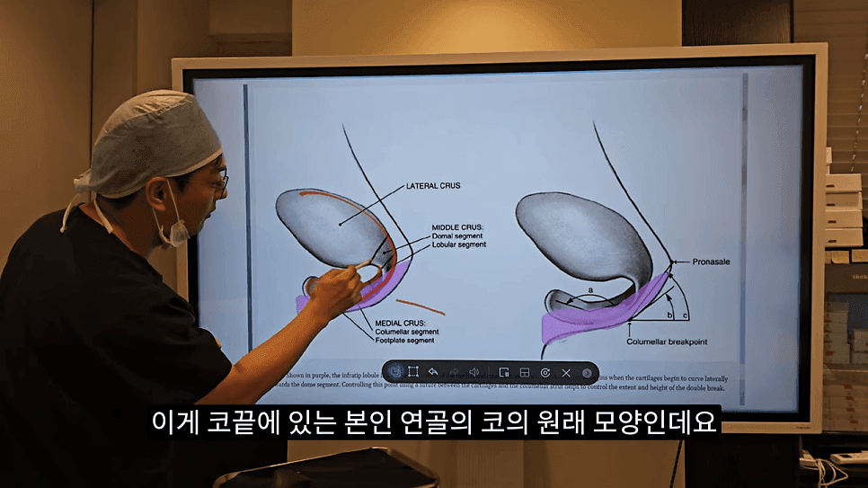사각코성형이란 — 비주가 살짝 꺾이는 디자인이 자연스러워 보이는 이유 관련 이미지 11/25