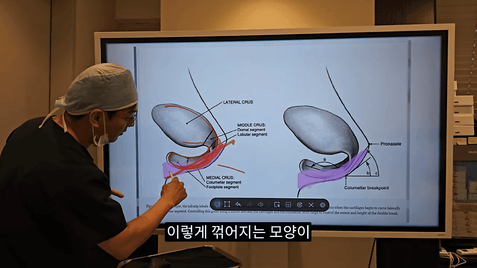 사각코성형이란 — 비주가 살짝 꺾이는 디자인이 자연스러워 보이는 이유 관련 이미지 12/25