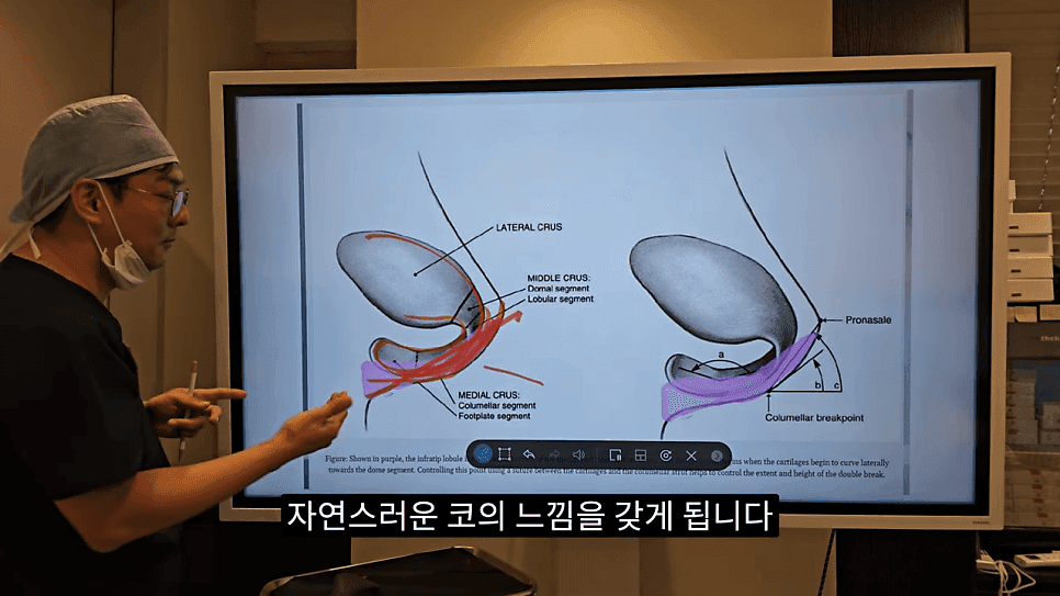 사각코성형이란 — 비주가 살짝 꺾이는 디자인이 자연스러워 보이는 이유 관련 이미지 13/25