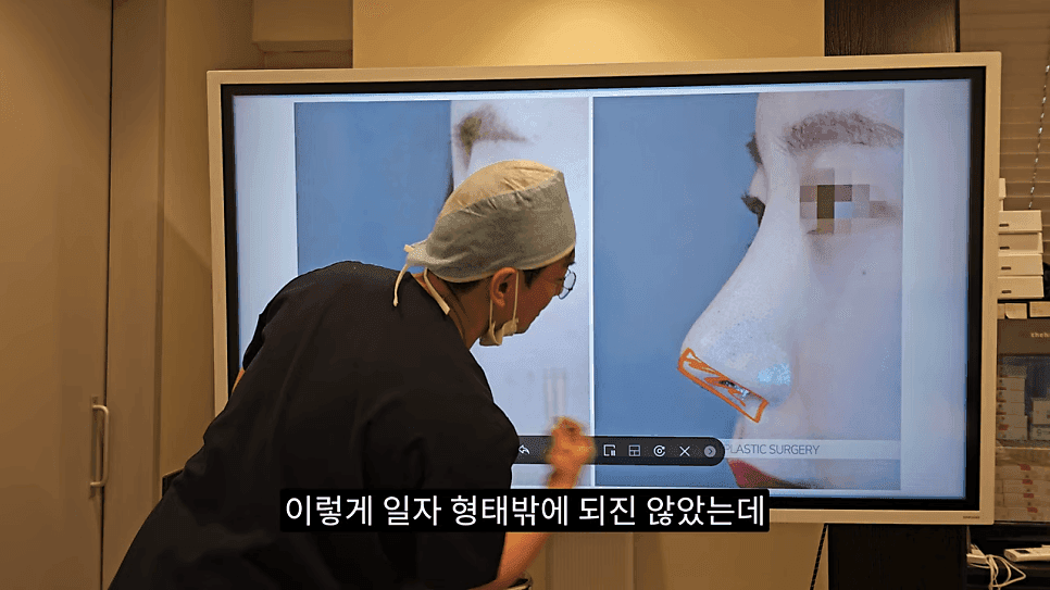 사각코성형이란 — 비주가 살짝 꺾이는 디자인이 자연스러워 보이는 이유 관련 이미지 15/25