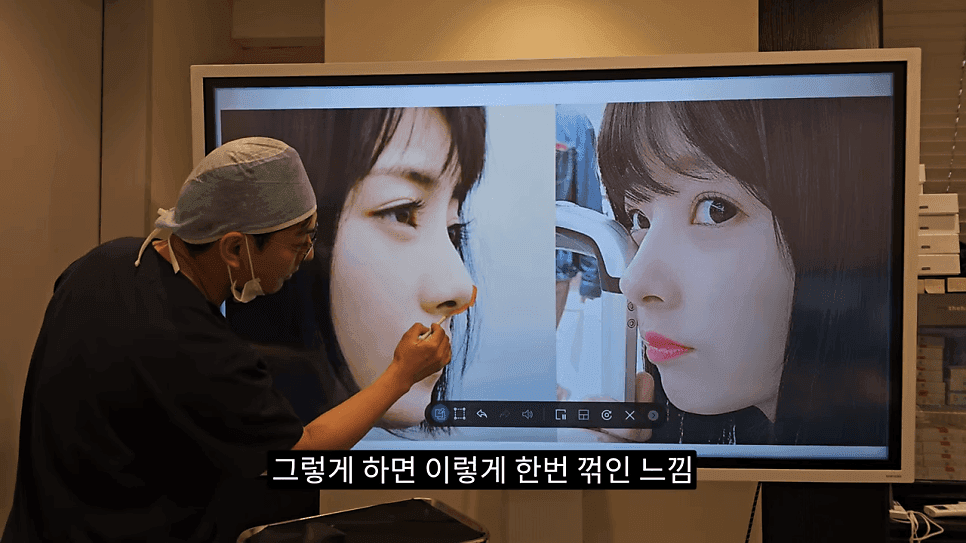 사각코성형이란 — 비주가 살짝 꺾이는 디자인이 자연스러워 보이는 이유 관련 이미지 17/25