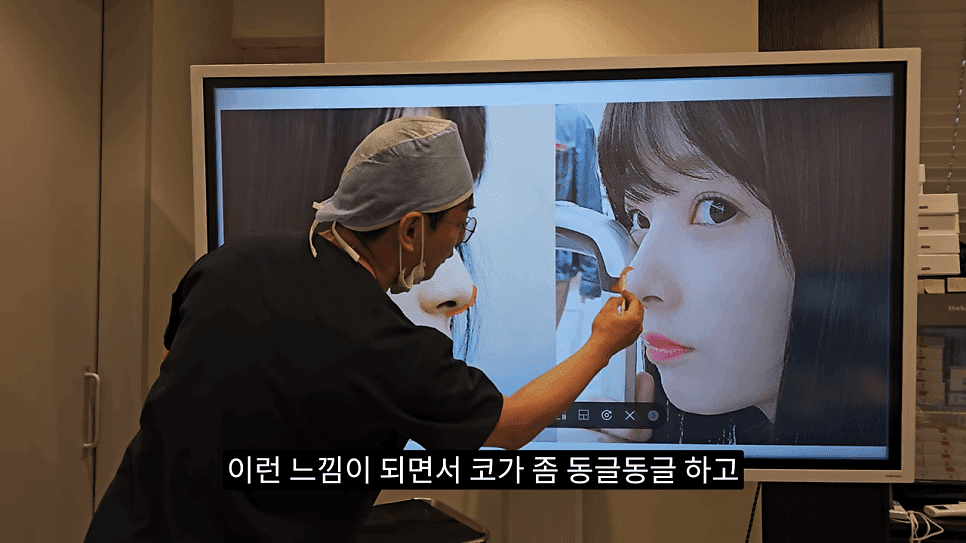 사각코성형이란 — 비주가 살짝 꺾이는 디자인이 자연스러워 보이는 이유 관련 이미지 18/25