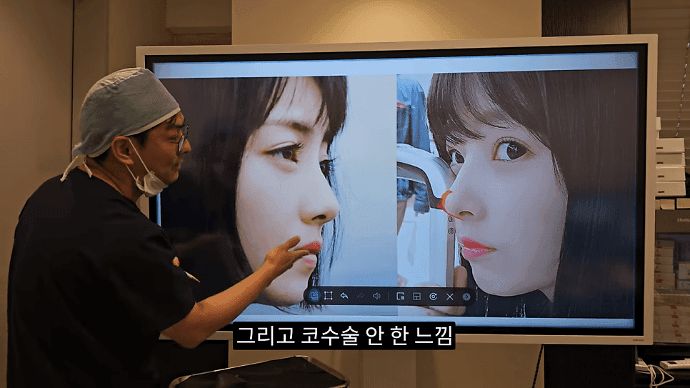 사각코성형이란 — 비주가 살짝 꺾이는 디자인이 자연스러워 보이는 이유 관련 이미지 19/25