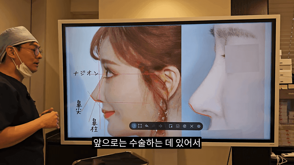 사각코성형이란 — 비주가 살짝 꺾이는 디자인이 자연스러워 보이는 이유 관련 이미지 21/25