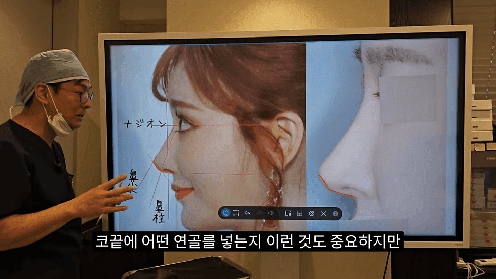 사각코성형이란 — 비주가 살짝 꺾이는 디자인이 자연스러워 보이는 이유 관련 이미지 22/25