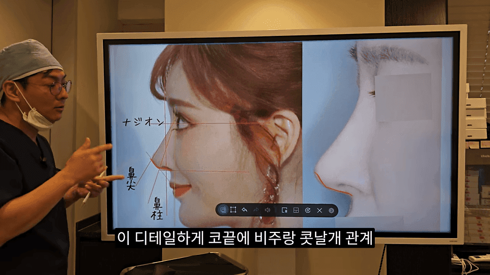사각코성형이란 — 비주가 살짝 꺾이는 디자인이 자연스러워 보이는 이유 관련 이미지 23/25