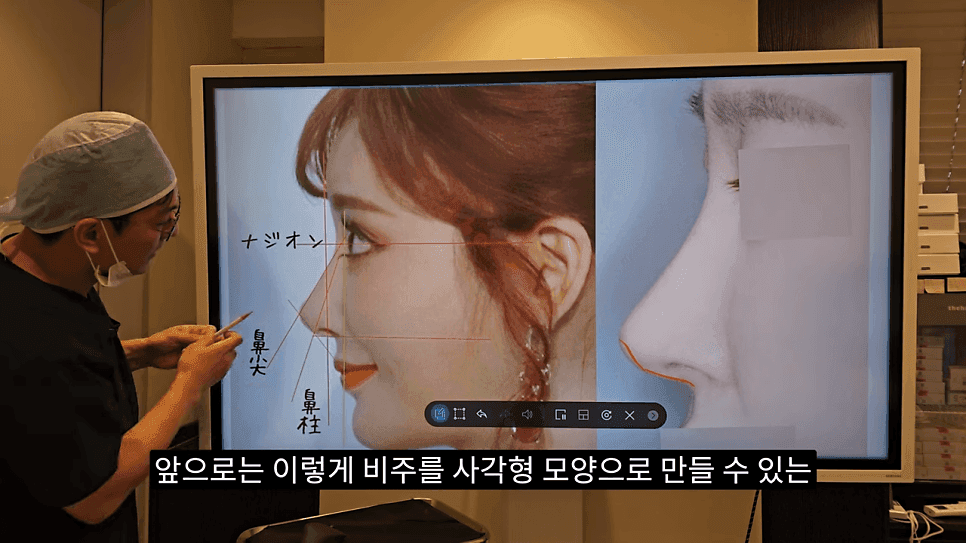사각코성형이란 — 비주가 살짝 꺾이는 디자인이 자연스러워 보이는 이유 관련 이미지 24/25