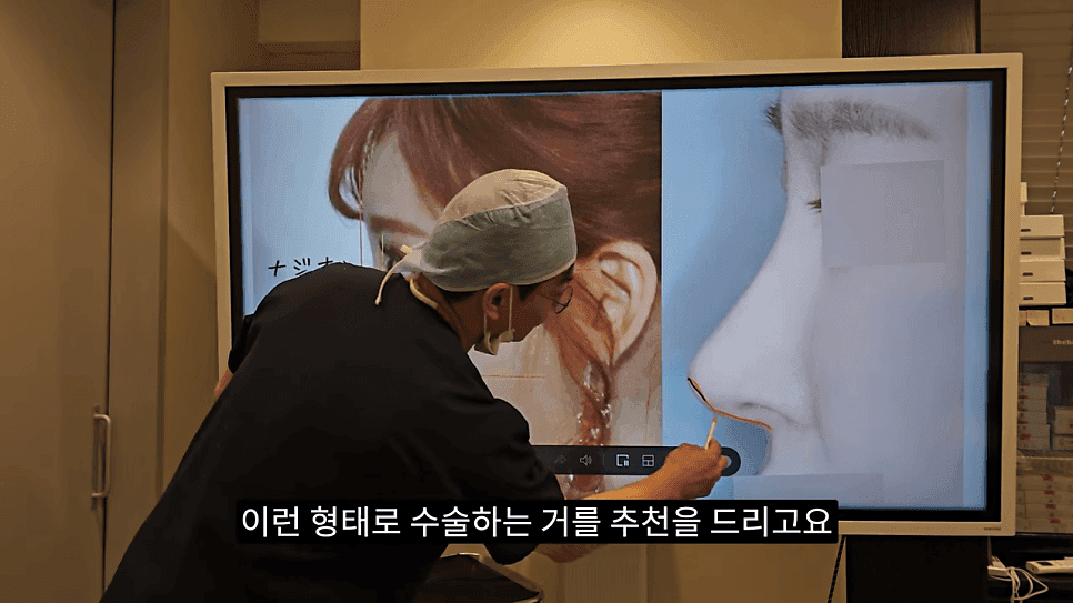 사각코성형이란 — 비주가 살짝 꺾이는 디자인이 자연스러워 보이는 이유 관련 이미지 25/25