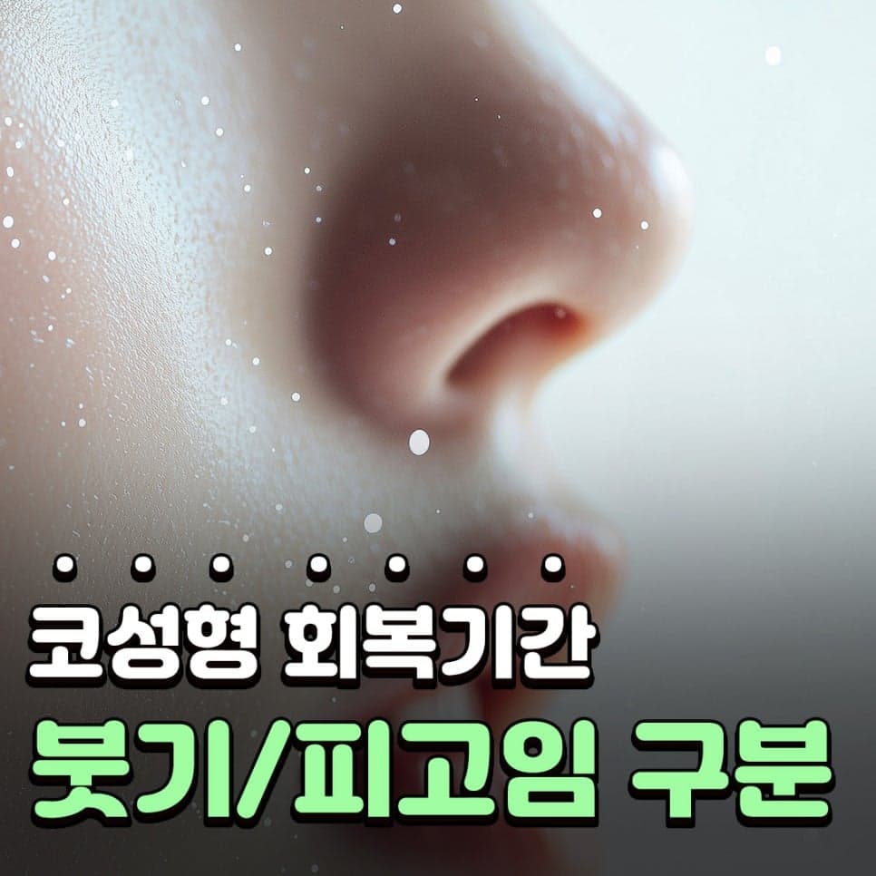 코성형 후 붓기일까 피고임일까 — 단단한 붓기와 콧대 재수술 시기 관련 이미지 1/9